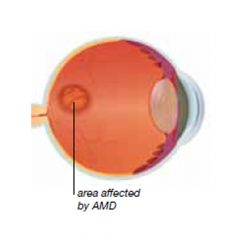 AMD-eyes AMD-eyes