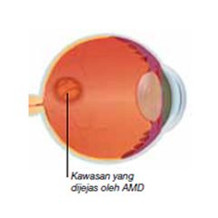 amd-mata amd-mata